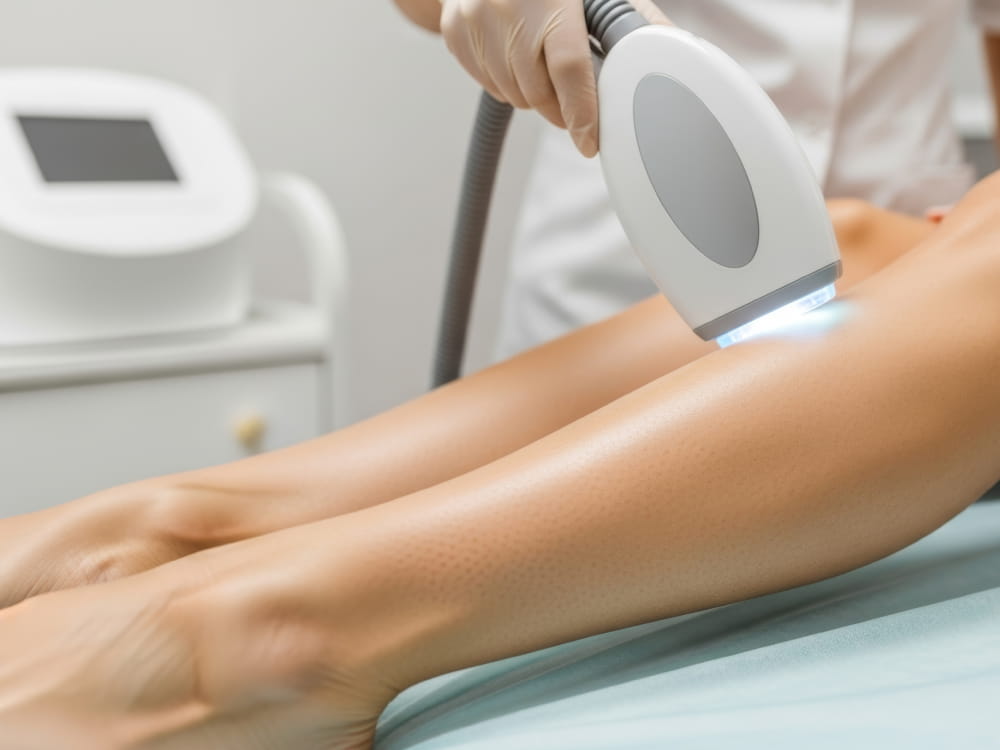 光脱毛の治療