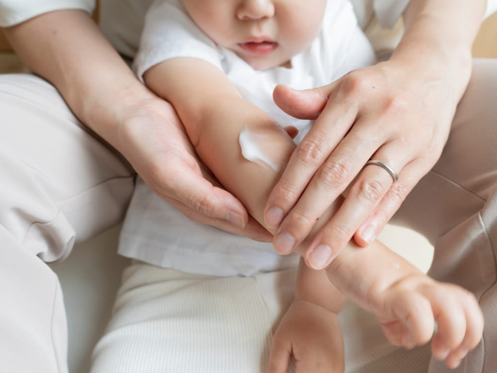 アトピー性皮膚炎